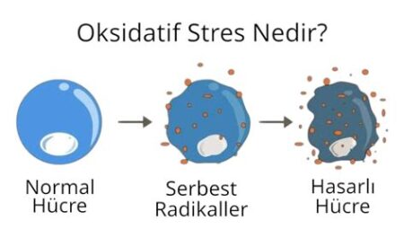 Serbest Atış Stresi
