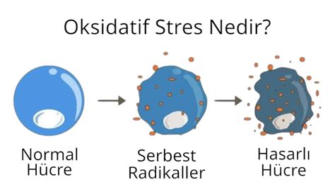 Serbest Atış Stresi